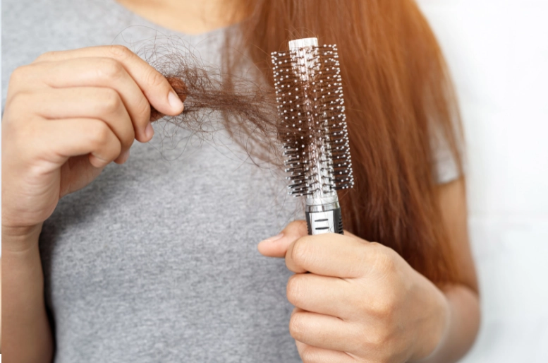 Hair Loss Hair Loss